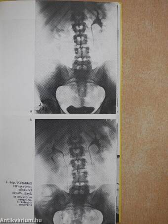 Az urológia válogatott fejezetei (diagnosztika)