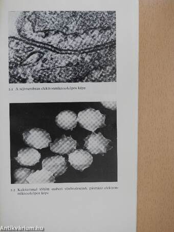 Membránok és membránbetegségek