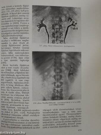 Belbetegségek elkülönítő diagnózisa I-II.