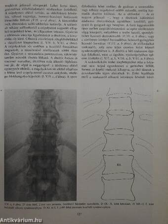 Ízületi betegségek röntgendiagnosztikája