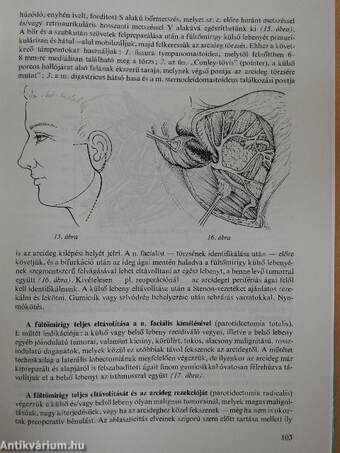 A daganatok sebészete