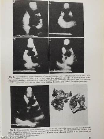 Progress in Cardiology 9