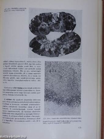 Pathologia I. (töredék)