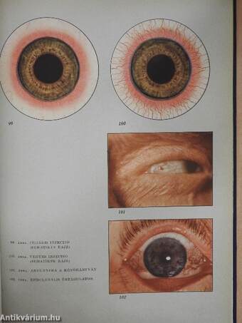 A szembetegségek atlasza I-II.