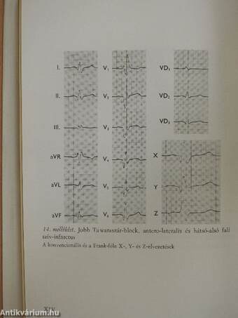 Electrocardiographia az orvosi gyakorlatban