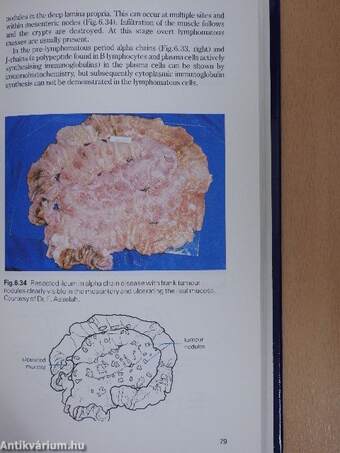 Diseases of the Small Intestine, Pancreas and Colon