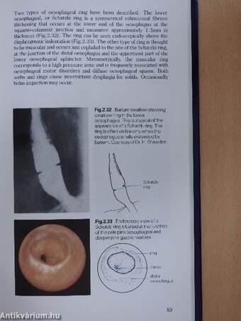 Diseases of the Oesophagus, Stomach and Duodenum