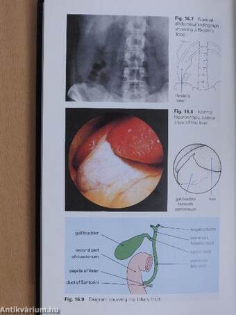 Diseases of the Anus and Congenital Conditions