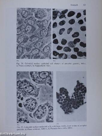 Atlas of Gastrointestinal Cytodiagnosis