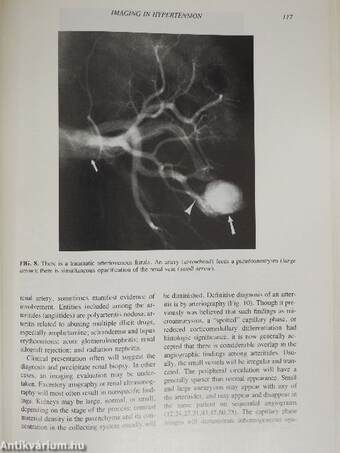 The Kidney in Hypertension