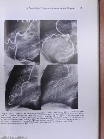 Progress in Cardiology 6