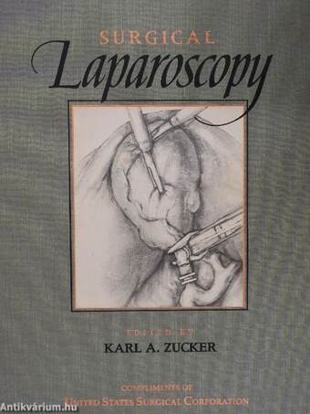 Surgical Laparoscopy