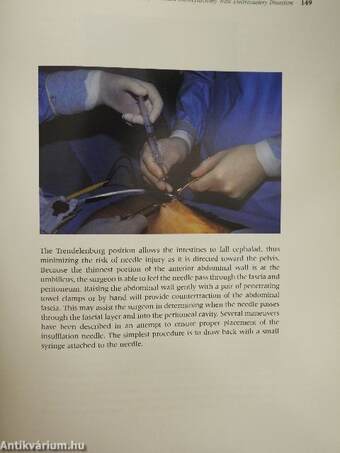 Surgical Laparoscopy