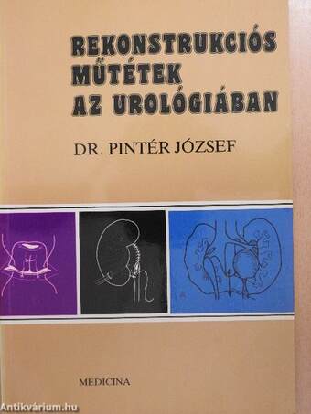 Rekonstrukciós műtétek az urológiában