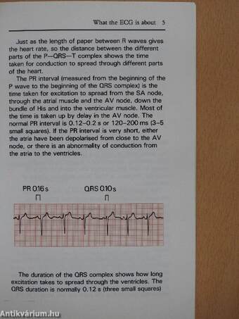 The E.C.G. Made Easy