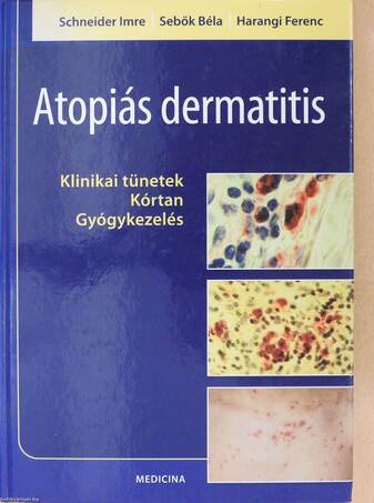 Atopiás dermatitis (dedikált példány)