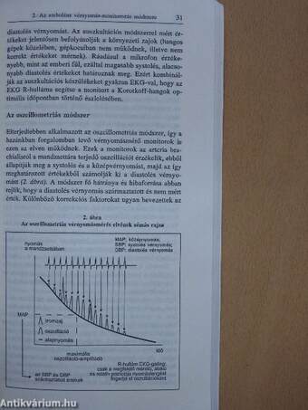 Ambuláns vérnyomásmonitorozás és gyakorlati alkalmazása
