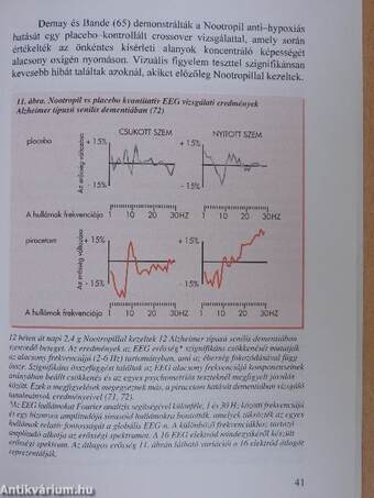 Nootropil (piracetam) monográfia