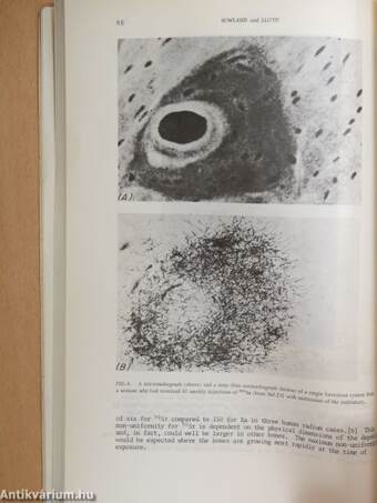 Environmental Contamination by Radioactive Materials