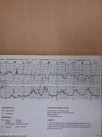 Fundamentals of Electronic Fetal Monitoring