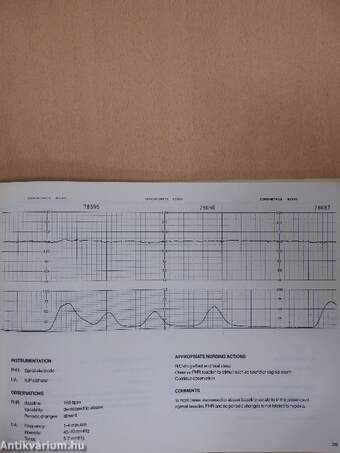 Fundamentals of Electronic Fetal Monitoring