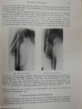 Unfallchirurgie im Röntgenbilde