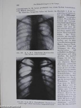 Differentialdiagnose der Lungenkrankheiten