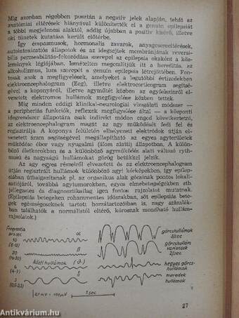 Görcsök és görcskészség a csecsemő és gyermekkorban