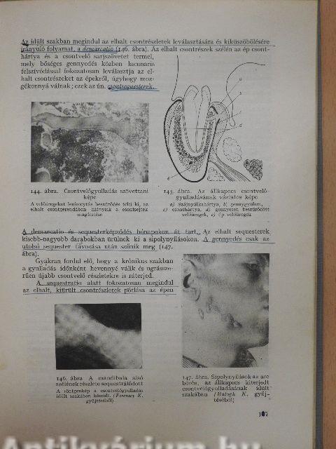 Fogászati pathologia