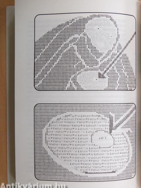 Múzsával vagy múzsa nélkül?