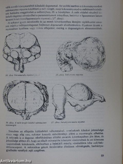 Nőgyógyászat