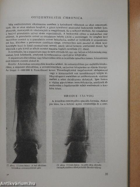 Az orthopaedia tankönyve