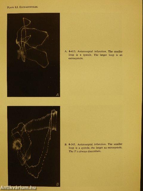 Spatiocardiography