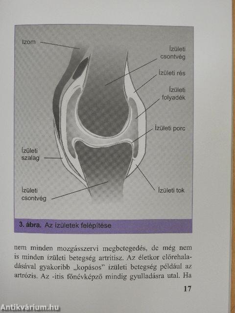 Reumatoid artritisz