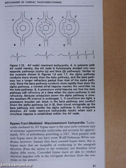 Antiarrhythmic Drugs