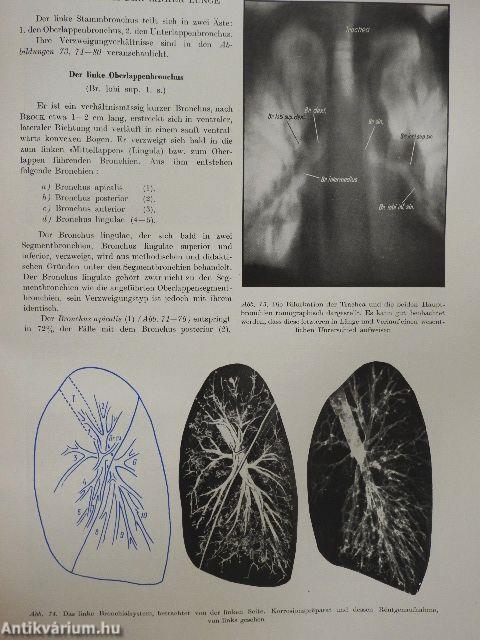 Röntgenanatomische Grundlagen Der Lungenuntersuchung