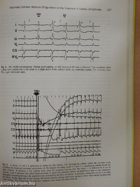 Progress in Cardiology 15