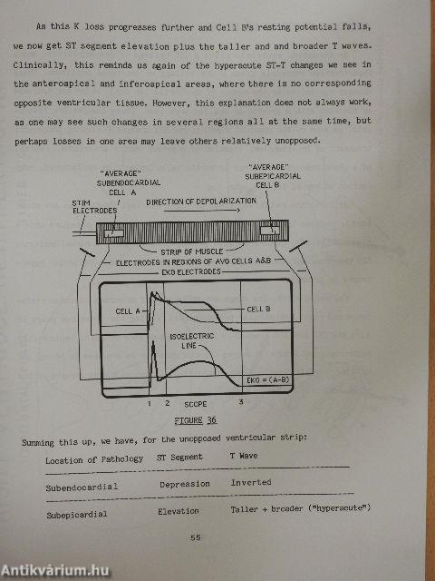 Fundamentals of Electrocardiography
