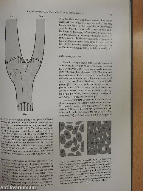 Neuroimaging Clinics of North America August 2002