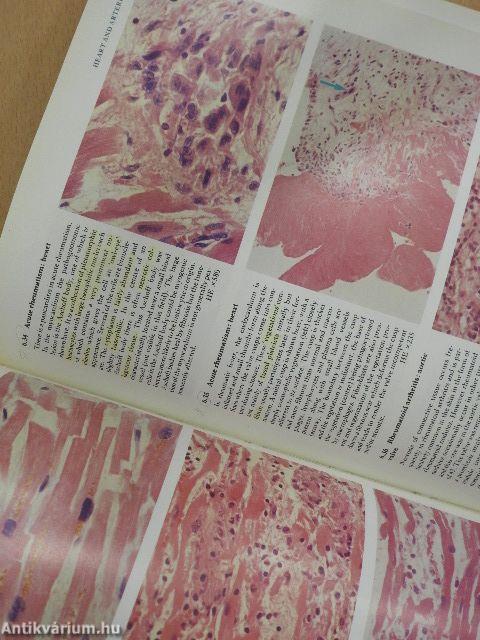 Color Atlas of Histopathology