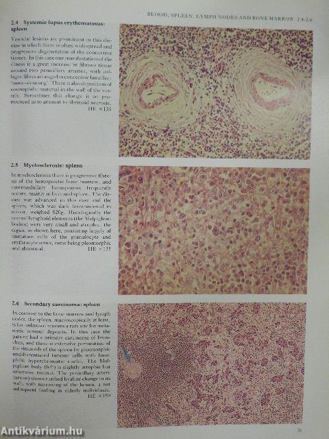 Color Atlas of Histopathology