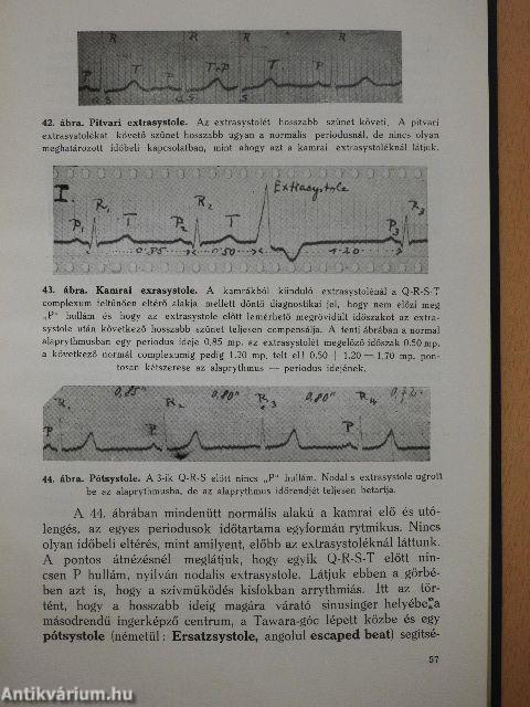 Elektrokardiographia