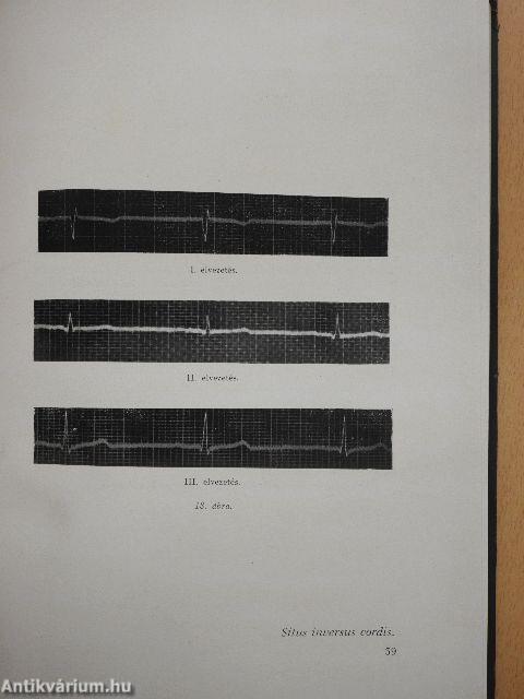 Gyakorlati elektrokardiographia II.