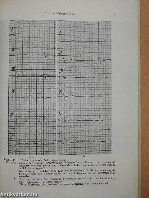 Atlas des EKG nach Frank