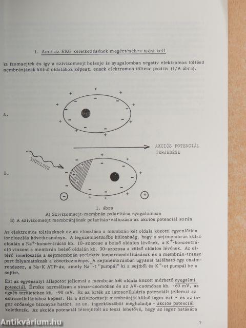 EKG-alapismeretek