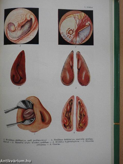 Fül-, orr-, gégegyógyászat
