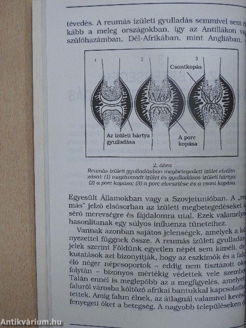 Hogyan orvosoljuk reumánkat és ízületi fájdalmainkat