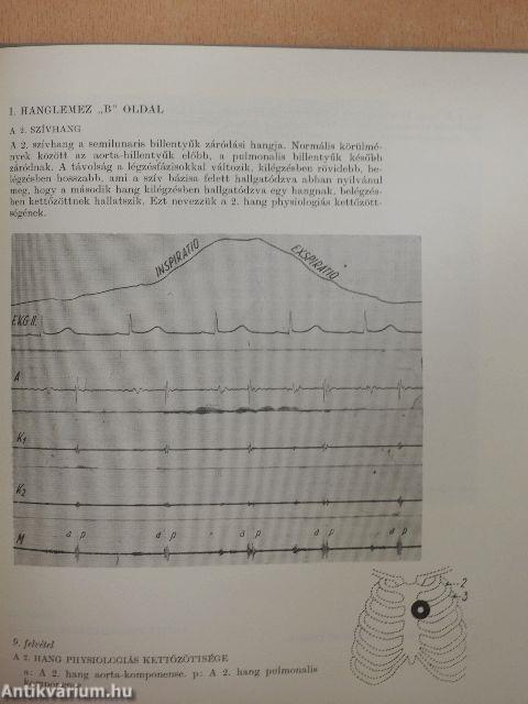 Hallgatódzás a szív felett I-II. - 6 db hanglemezzel