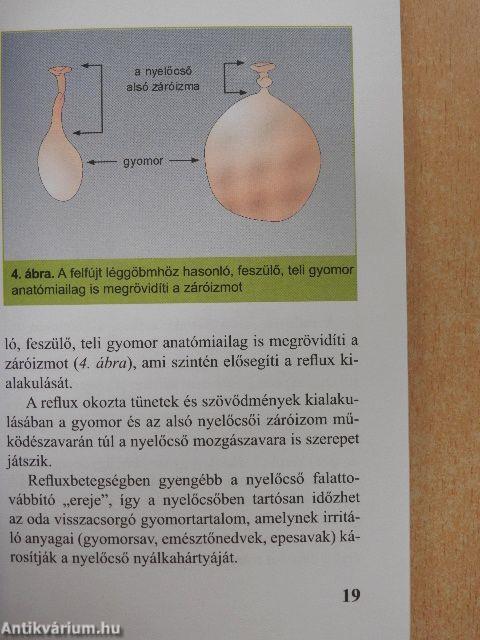 Refluxbetegség - gyomorsav okozta bántalmak