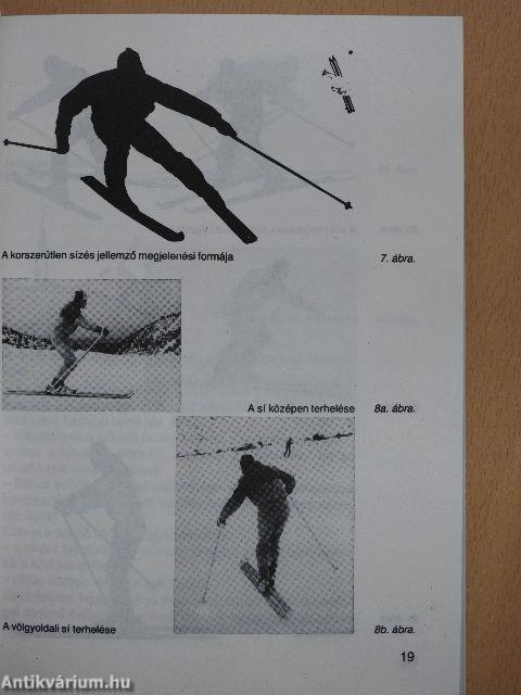 Mitől fordul a sí?